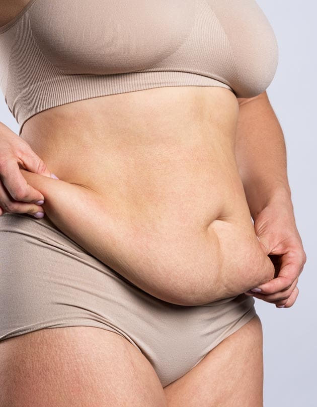 HR Plastic Sugery - Tummy pouch Common Causes